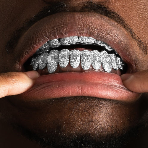 Stone on Center Moissanite Grillz
