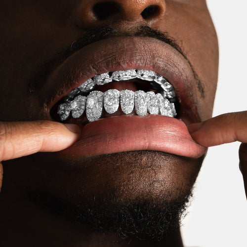 Stone on Center Moissanite Grillz